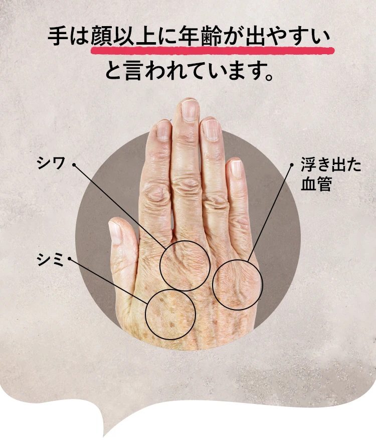 Skindex（スキンデクス）ホワイトハンドセラム,効果なし,評判,口コミ